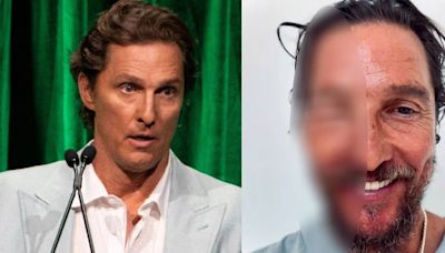 Matthew McConaughey fue picado por una abeja en la cara y su foto se hizo viral