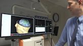 Univ. of Iowa Health Care looks into how transcranial magnetic stimulation impacts the brain