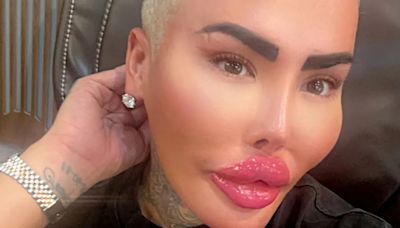 Kardashian-obsessed TV star ‘Lip King’ arrested over death of BBL mum-of-five