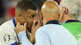 ¡Qué siempre no! Mbappé tiene la nariz rota, pero no será operado | Fútbol Radio Fórmula