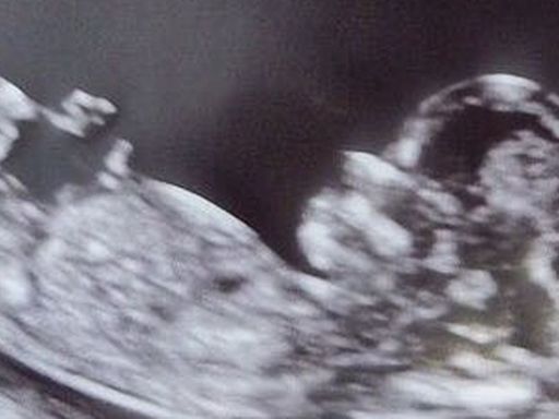 Men should pay child support from the moment women know they’re pregnant | Letters