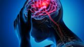 Neurologe über World Brain Day - Jeder 2. klagt über neurologische Symptome: Präventive Maßnahmen können helfen