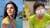 Television star Jasmin Bhasin suffers corneal damage due to mishap with her lenses, says 'Went to see a doctor but…'