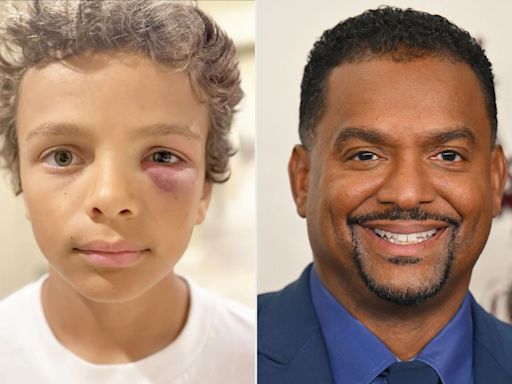 Alfonso Ribeiro's Wife Angela Says Son AJ, 10, Is 'Healing' After Getting a Black Eye from Baseball