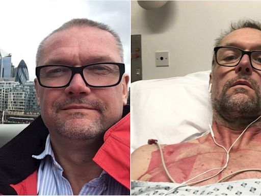 Man diagnosed with rare syndrome after symptoms mistaken for a vitamin B deficiency