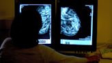 Breast cancer patients ‘waiting for years before reconstruction surgery’