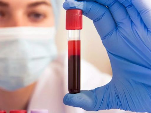 New Blood Test To Detect Colon Cancer Approved By FDA