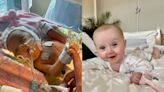 Baby given hours after being born with ‘dead bowel’ defies doctors