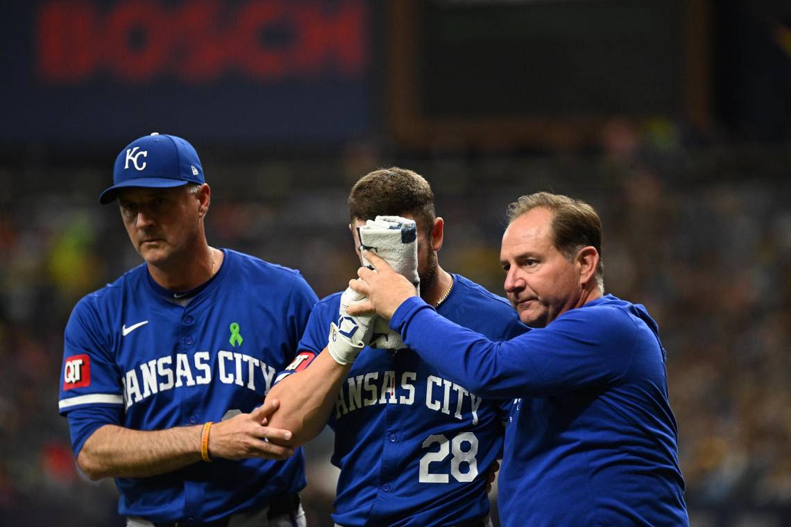 Kansas City Royals’ Kyle Isbel leaves game after taking a foul ball to the face