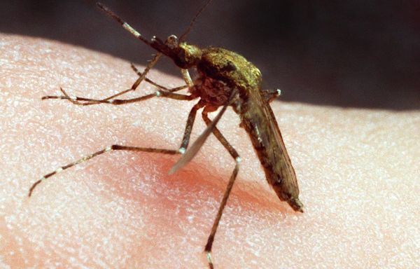 Mosquito bites are a pain. A doctor weighs in on how to ease the discomfort.