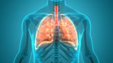 Cystic fibrosis: global clinical trials landscape and treatments