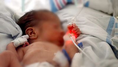 Nacen trillizos en el Hospital General Torre Materno Infantil