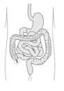 Appendix (anatomy)