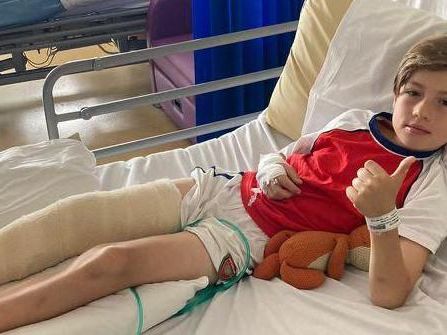 Boy needed surgery after falling on glass in park