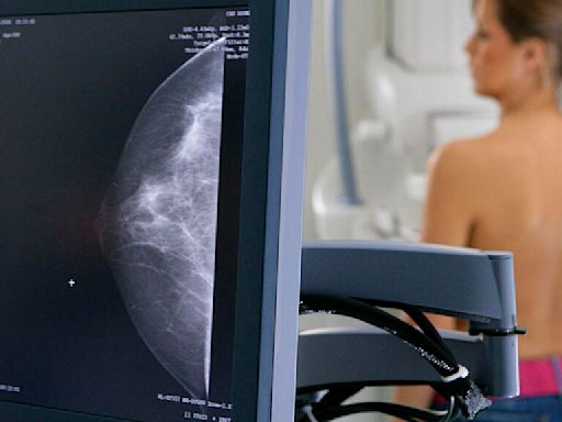 Cáncer de mama: las desigualdades socio económicas afectan la calidad de vida de las pacientes