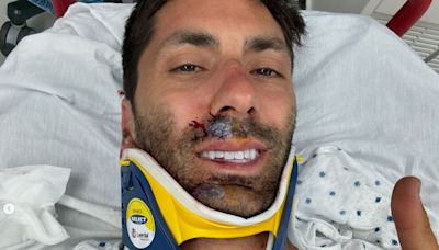 Catfish presenter Nev Schulman breaks neck in bike crash