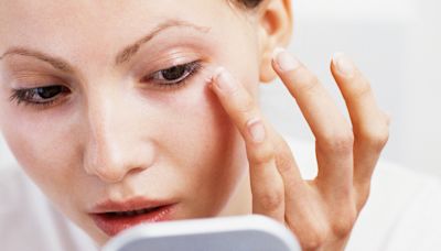 Tighten under-eye bags with 3 ingredients but don't miss 'crucial' prevention