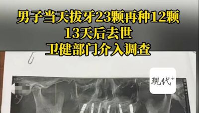 1天內拔牙23顆、植牙12顆 中國男疼痛難耐2週後死亡