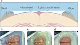 窺視大腦深處：奈米科技開啟神經成像新紀元