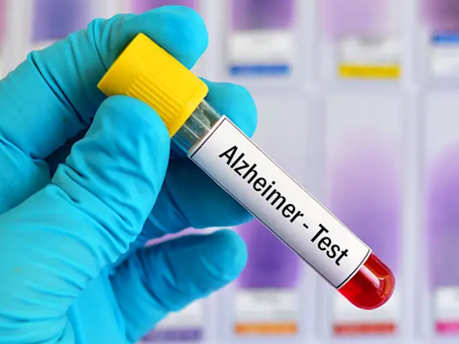 Blood tests for Alzheimer's may be coming to your doctor's office. Here's what to know