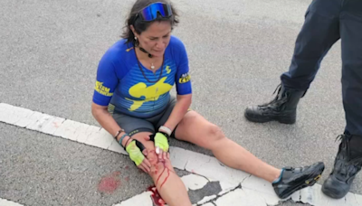 Policía investiga la brutal agresión a una ciclista en Key Biscayne