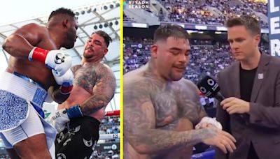 Andy Ruiz Jr shows off nasty broken hand injury in draw with Jarrell Miller