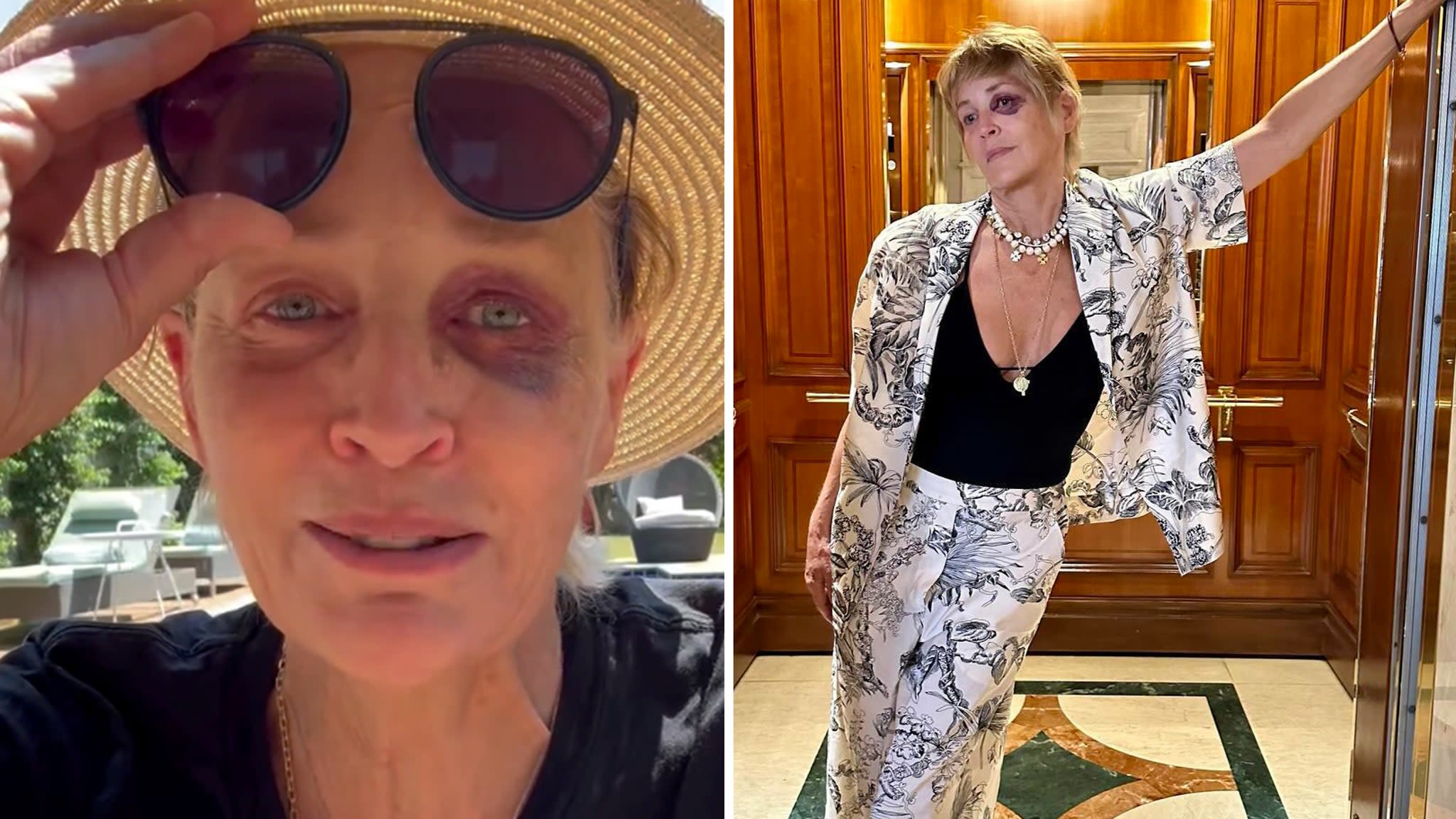 Sharon Stone Reveals How She Got Black Eye Following Fan Concern: 'A Good Looking Shiner'