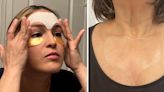 Wrinkle patches are super trendy on TikTok — but do they actually work? Experts weigh in.