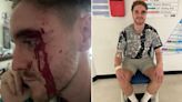 Exclusive: Gay couple viciously attacked by gang armed with ‘wooden panel with nails in’