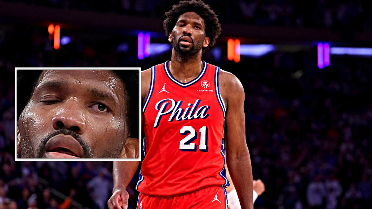 Sports Doctor Discusses His Concerns on Joel Embiid's Bizarre Eye Movements | FOX Sports Radio