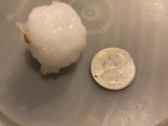Denver weather: Thursday’s hailstorm was unexpected — here’s how it happened