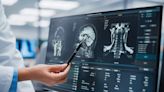 Brainomix swings FDA clearance for its lung imaging AI software