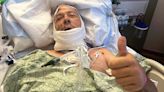 Navy Vet's Jaw Torn Off After Being Attacked by Bear: 'The Whole Bottom Part of His Mouth Is Gone'