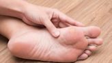 Bump on Toe: Causes and Treatments