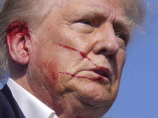 Blood scarred: Editorial on assassination attempt on Donald Trump and history of political violence in USA