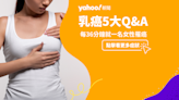 乳癌症狀有哪些？「婦女癌症發生率第一位」乳癌存活率高嗎？乳癌檢查又該怎麼做？