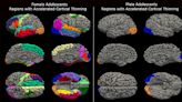 Novo estudo mostra que o lockdown da pandemia acelerou o envelhecimento cerebral das adolescentes em até 4 anos; entenda