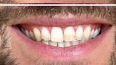 Teeth whitening powder that makes teeth 'whiter in weeks'