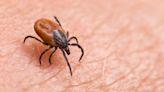 As ticks spread, the US is getting smart about reporting infections and seeing the true extent of Lyme disease