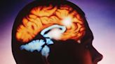 Surgery targeting brain region may relieve tough-to-treat epilepsy