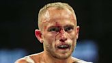 Edwards booed after horrific cut in comeback fight after losing world title
