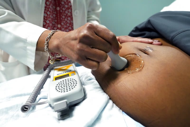 New CDC data shows maternal mortality rates dropped in 2022; Doula highlights need for solutions for women of color