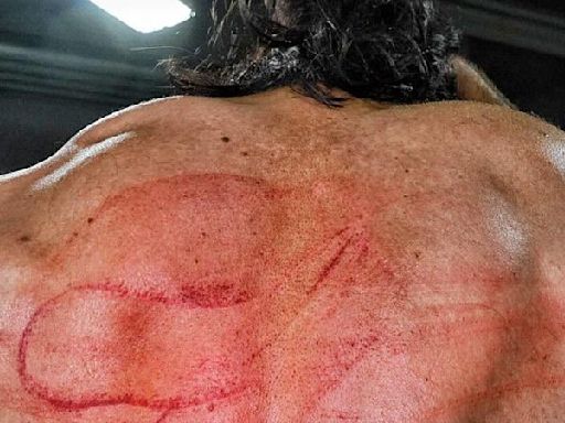 Drew McIntyre Shows Off His Wounds After CM Punk Whipped Him With A Belt On WWE RAW