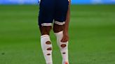 England fans baffled as players cut holes in their socks – but there's a reason