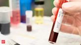 HIV breakthrough: Drug trial shows injection twice a year is 100% effective against infection