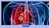 World Lung Cancer Day 2024: 6 subtle signs you need to watch out for