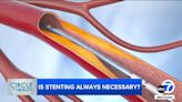 Heart stents can save lives, but are too many Americans getting them unnecessarily?