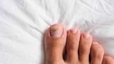 What Are the Different Types of Toenail Fungus?