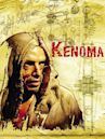 Kenoma