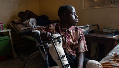 Kidnapped by One Side, Maimed by the Other: A Teenager’s Ordeal in Congo’s 30-Year War